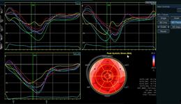 Vivid E95 and E90: AFI BE Map