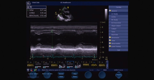 Vivid S6/S5: Basic System Operation - An introduction to the measurement package 