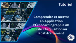 Comprendre et mettre en Application l’Échocardiographie 4D ...