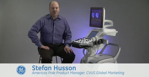 Vivid E9 BT12 Enhancements: New 4D Image Optimization 