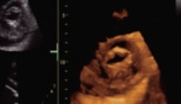 4D Imaging White Paper