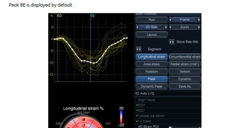 Vivid E95: 4D Strain Rotation and Torsion Dynamic and Static ...