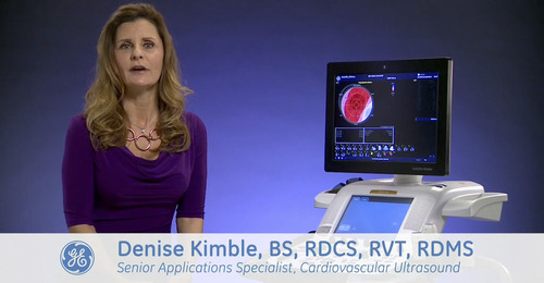 Vivid E9 with XDclear: Automated Functional Imaging