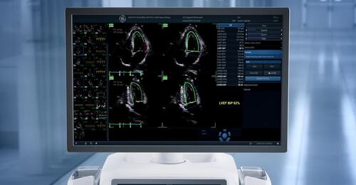 Fast, Accurate Ejection Fraction