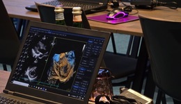 4D Echo & Multidimensional Imaging Echo Course