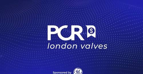Innovation and imaging guidance for tricuspid valve replacement - Nicolas Dumonteil, Didier Tchetche, Georg Nickenig, Nina Wunderlich