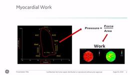 Myocardial Work - Why?