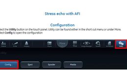 Vivid E95 and E90: Stress Echo with Integrated AFI Workflow 