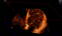 EchoPAC: How to Process 4D