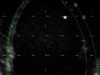Vivid E9: From EF to Mass to 4D Strain