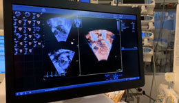 Dr Ferran Rosés Noguer – AEPC 2021: 6VC-D: New 4D pediatric and neonatal transthoracic probe