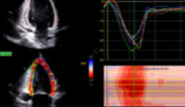 Strain Imaging: Methods, Cases and Outcomes – Dr. Christian Breburda