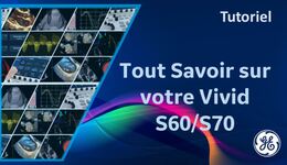 Questions autour de votre Vivid S60/S70
