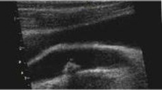 Vascular Imaging Case Study for Vivid 7
