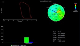 Myocardial Work White Paper
